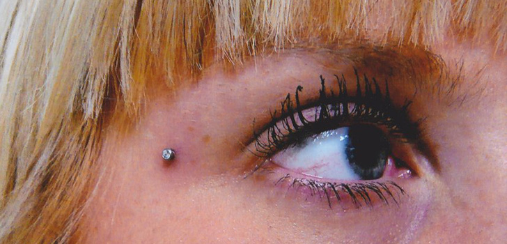 Microdermal piercing: hvordan microdermabras er lavet (foto)