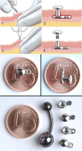 Microdermal piercing: hvordan microdermabras er lavet (foto)