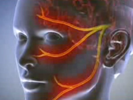 Neuralgi: symptomer, fotos, behandling